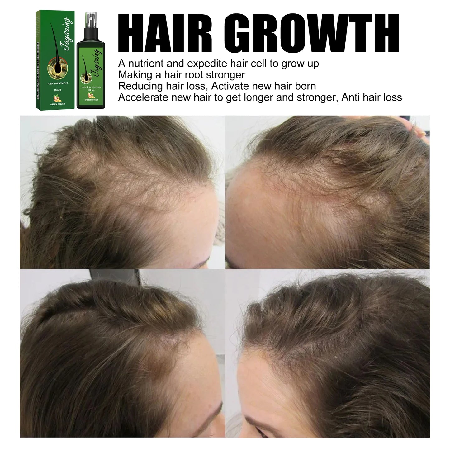 Nourishing Hair Care Serum Spray – Scalp Massage, Moisturizing & Smoothing Treatment