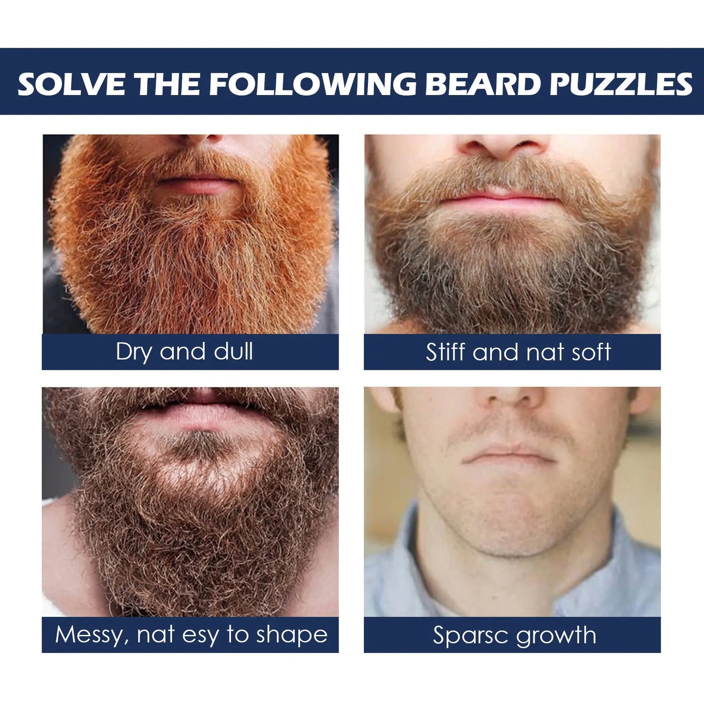 Beard Growth Oil for Men – Nourishing Thickening & Grooming Treatment (30ml)