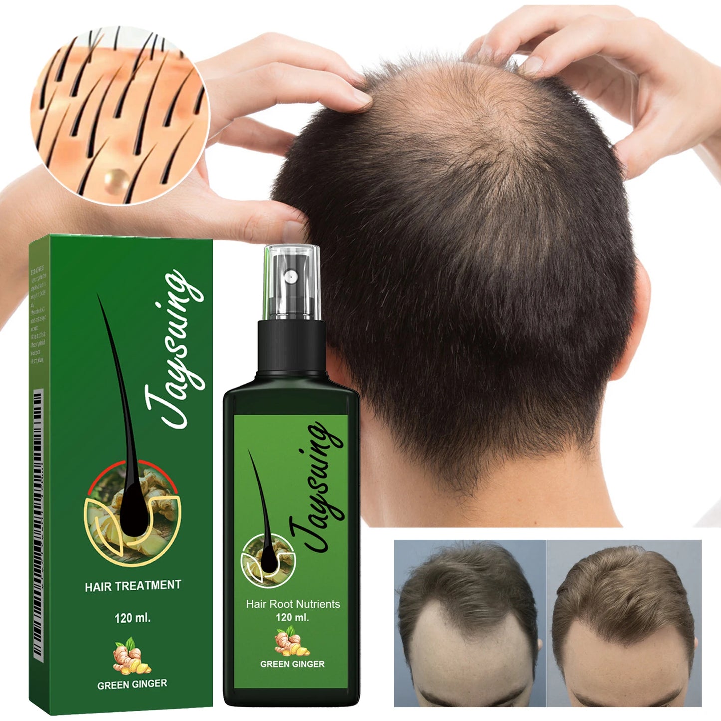 Nourishing Hair Care Serum Spray – Scalp Massage, Moisturizing & Smoothing Treatment