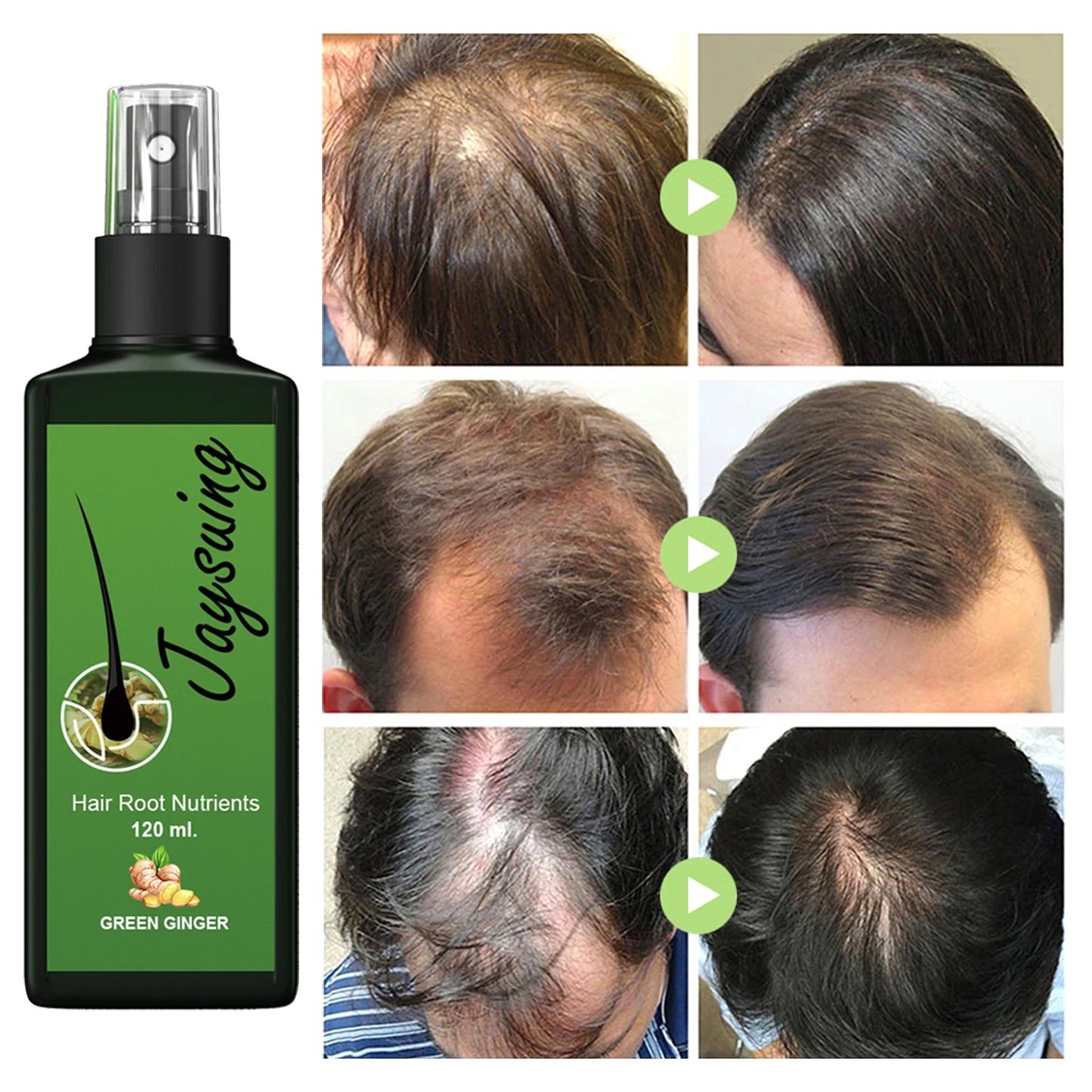 Nourishing Hair Care Serum Spray – Scalp Massage, Moisturizing & Smoothing Treatment