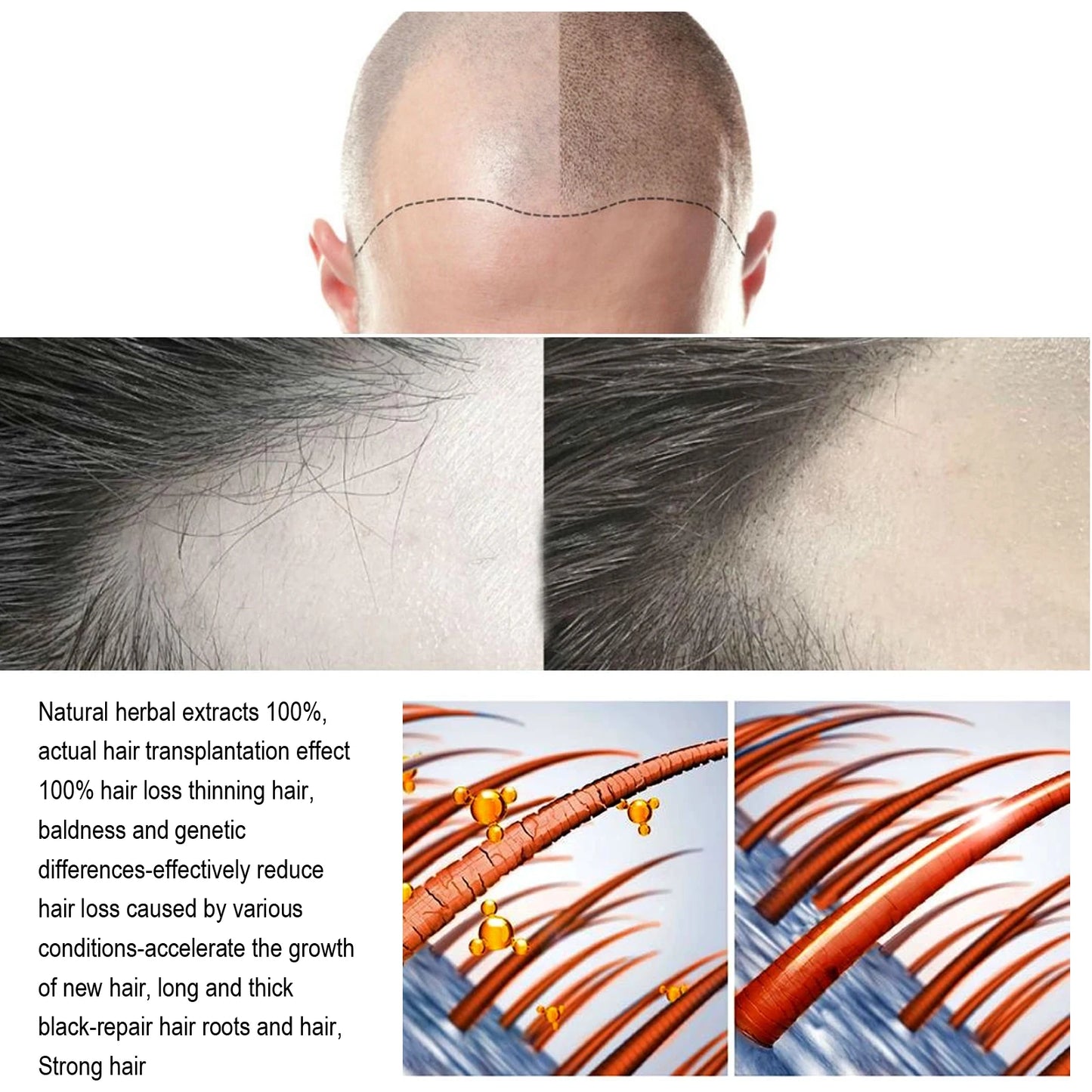 Nourishing Hair Care Serum Spray – Scalp Massage, Moisturizing & Smoothing Treatment