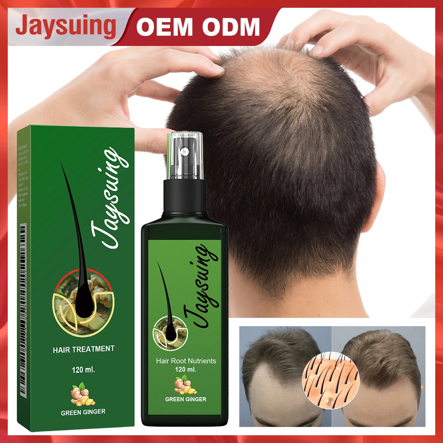 Nourishing Hair Care Serum Spray – Scalp Massage, Moisturizing & Smoothing Treatment